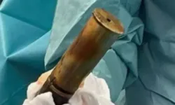 Anüsüne sıkıştırdığı bombayla acil servise gitti!