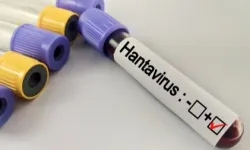 Hantavirüs salgına dönüşür mü? Kapalı alan temizliğinde büyük risk